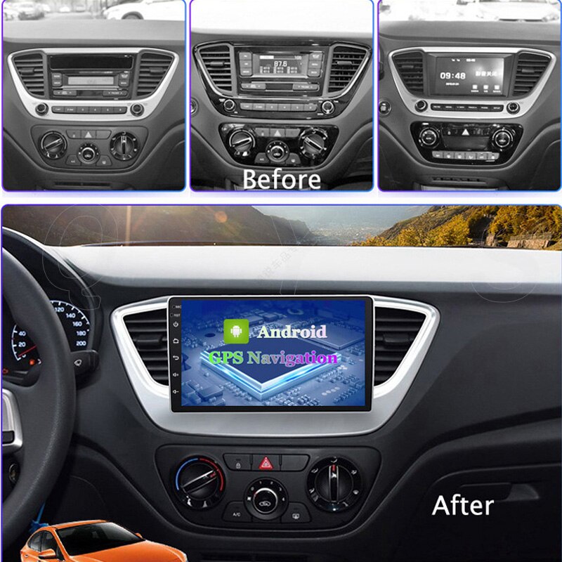 Consola para Hyundai Verna / Solaris 2017 (9 Pulgadas)